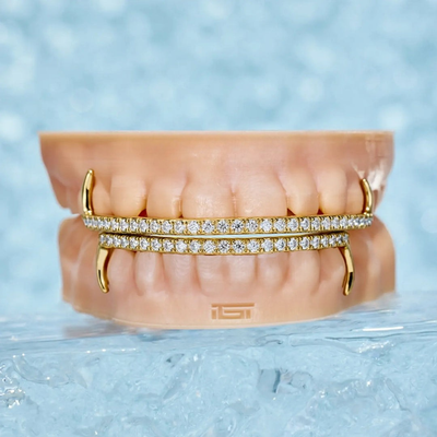 Custom Grillz