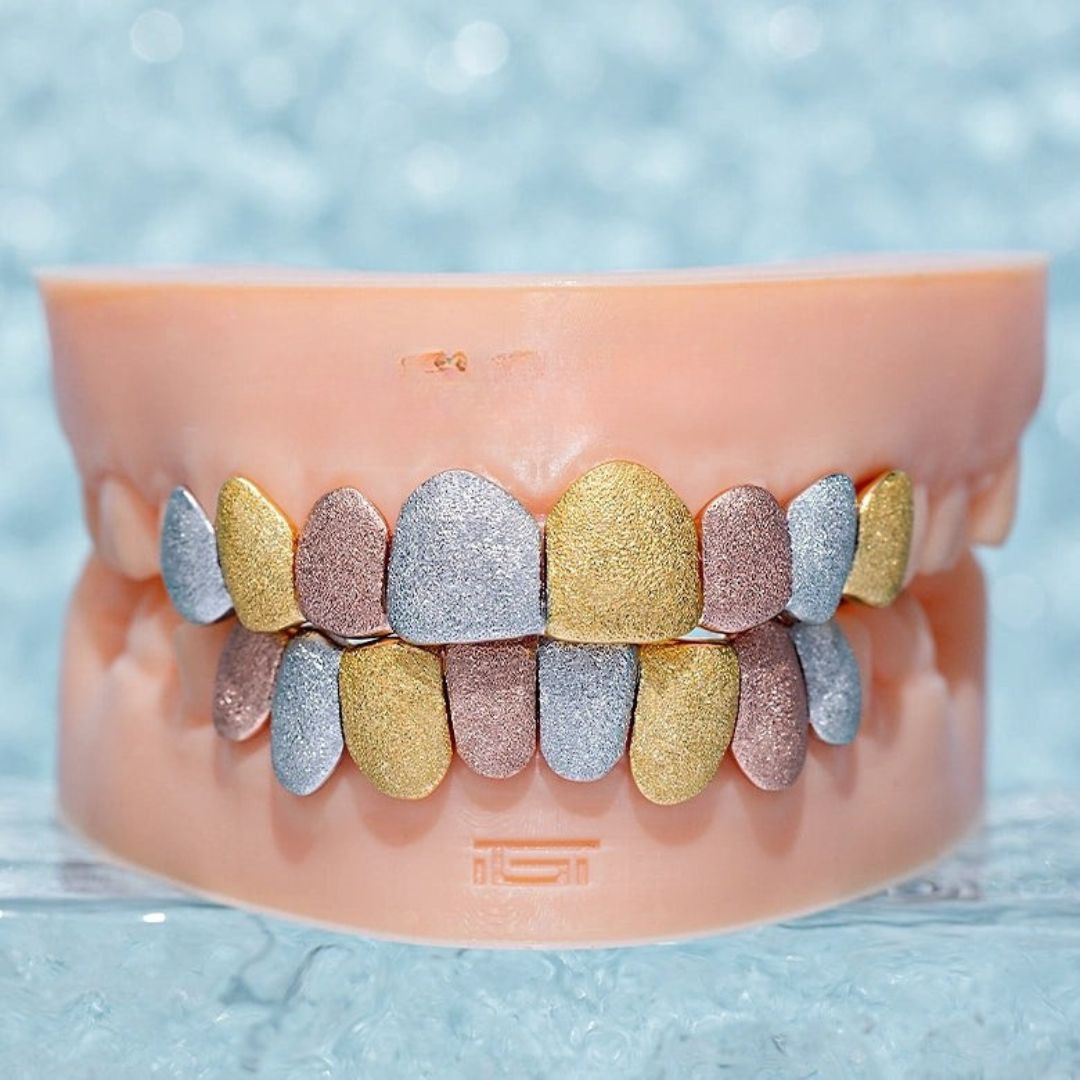 Custom Tri-Tone Diamond Dust Grillz
